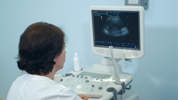 Female Doctor Analyzing Ultrasound Results