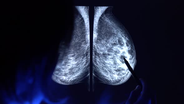 Doctor with a pan checking mammogram x-ray. Mammography diagnostic in 4k