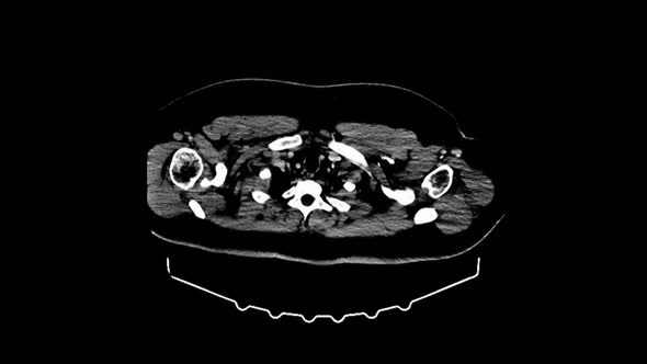 MRI of Human Illness Analysis on Magnetic Resonance Imaging Sagittal View alt