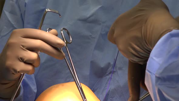 Knee Ligament Surgery 4