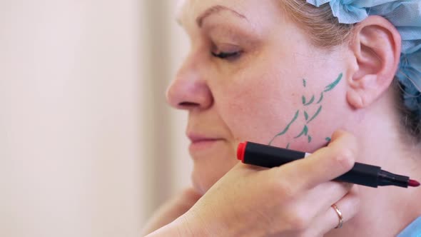 Picture of Adult Woman 50S60s Standing Still in Profile in Medical Hat While Nurse Putting Markings alt
