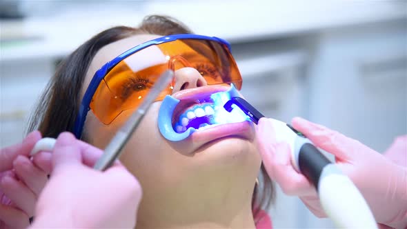 Dentist With Assistant Using Ultraviolet Lamp On Patients Teeth.