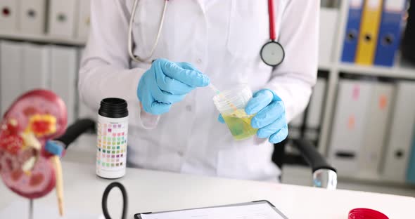 Doctor Urologist Making Express Urine Test Using Indicator Paper Closeup  Movie alt