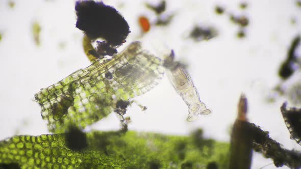 A Bdelloid Rotifer Under The Microscope alt