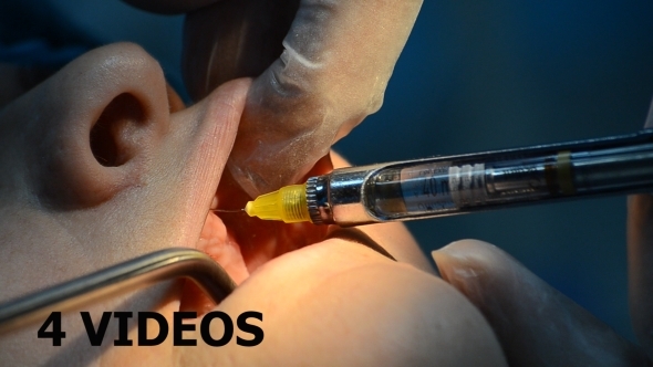 Dental Surgery 01 - 4 Videos