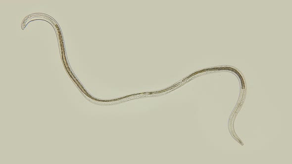 A Nematode Worm Under a Microscope, There Are Free-living, Commensals and Parasites alt