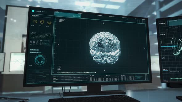Medical oncology laboratory is checking the Patient's Brain for abnormalities alt