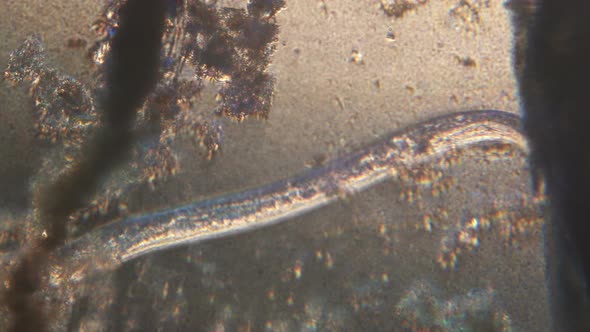 Microscopy of parasite worm nematode
