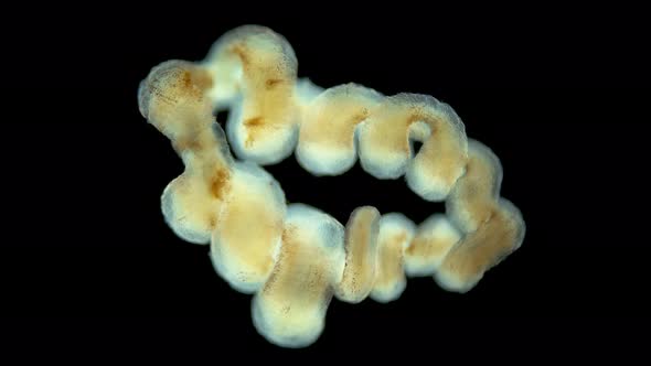 A Worm Under a Microscope Long Like a Parasitic alt