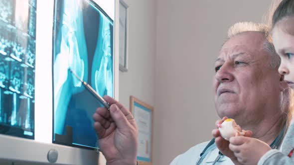 Surgeon and little kid examining X-ray images