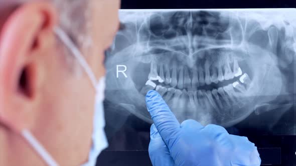 Dentist Close Up On X Ray
