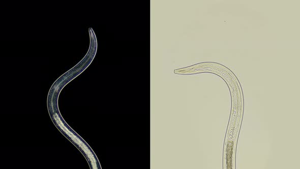 A Nematode Worm Under a Microscope, There Are Free-living, Commensals and Parasites alt