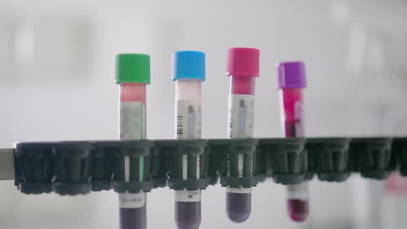 Test Tubes With Material for Laboratory Testing or Experiments. Medical Equipment for Research. alt