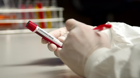 Scientist Marking Coronavirus Test Tube