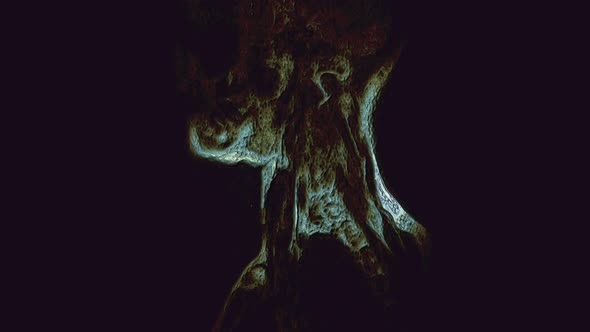 Bulk Multicolored MRI of the Cervical Spine, Detection of Protrusions and Hernias alt