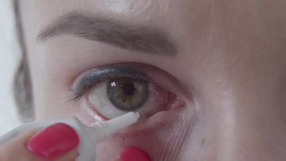 Female Using Medical Solution To Moisturise And Heal Her Eye With Stitches After Surgery Macro Shot alt