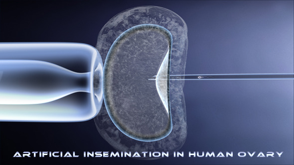 fertilization by micro injection