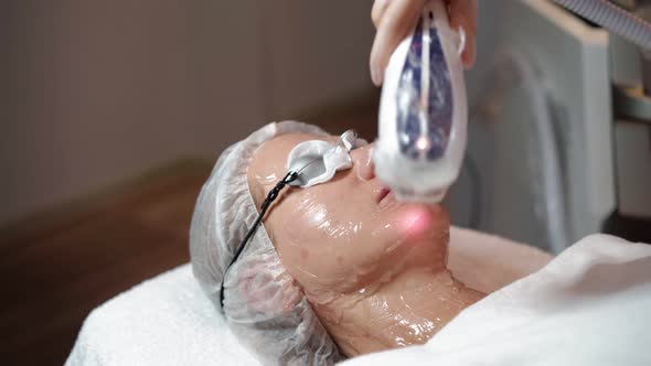 Beautician Prepares Laser Rejuvenation Facial Hair Removal Woman in Beauty Salon alt