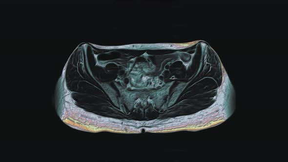Bulk Multicolored MRI of the Female Pelvic Organs Abdominal Cavity Gastrointestinal Tract and alt