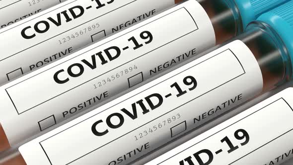 Covid-19 nasal swab laboratory tests