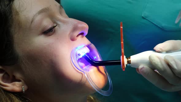 Visit To the Dentist, Installation of the Bracket System alt