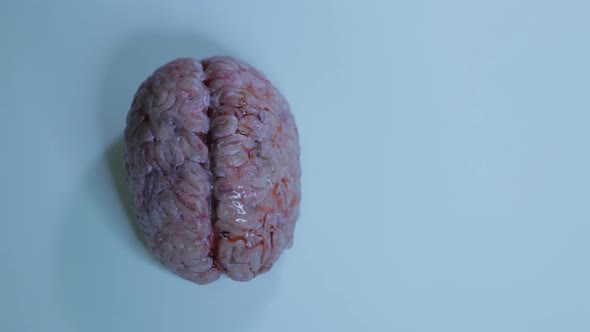 Brain Anatomical Model