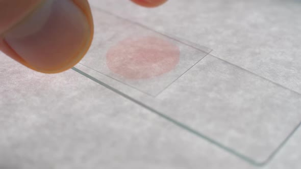 A Specimen Of Blood (Red Liquid) Is Placed On The Slide Of The Microscope 2