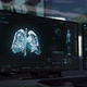 Futuristic X-ray Scanner Interface Detects Lung Cancer At A Medical Laboratory - VideoHive Item for Sale