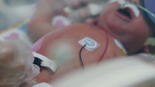 One Newborn Baby in Infant Incubator with Tubes. alt