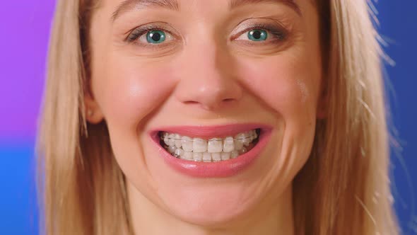 Woman with blue eyes and braces on her teeth smiles