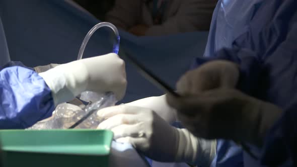 Surgeons working during surgery, close up on hands and instruments. alt