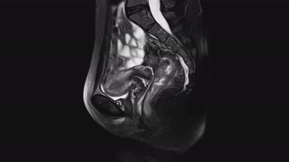 MRI of the Female Pelvic Organs, Abdominal Cavity, Gastrointestinal Tract and Bladder alt