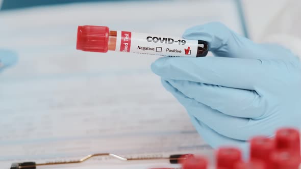 Close Up of Doctors Hand Holding Tube with Positive Blood Test for COVID-19 alt