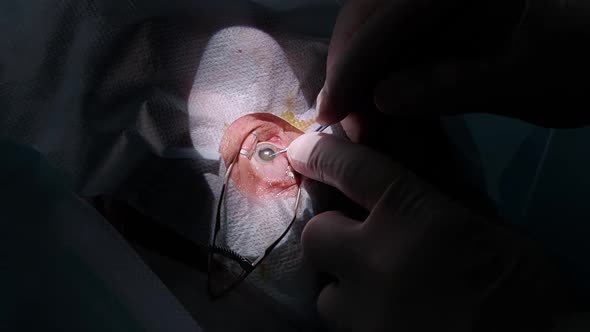 A Surgeon Injects Painkillers Before an Ophthalmic Eye Operation in the Operating Room at a Medical