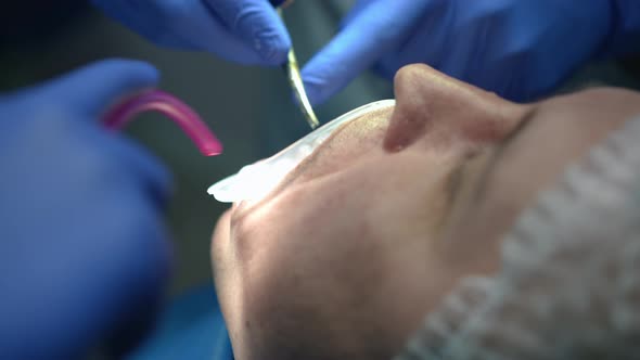 Closeup Caucasian Man in Dental Chair with Doctor and Assistant Using Dental Scissors and Sucking alt