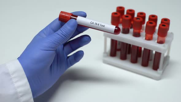 CA 19-9, Doctor Showing Blood Sample in Tube, Lab Research, Health Checkup alt