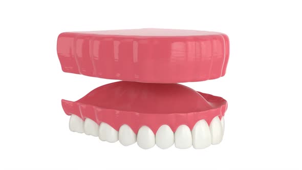 Removable traditional denture installation alt