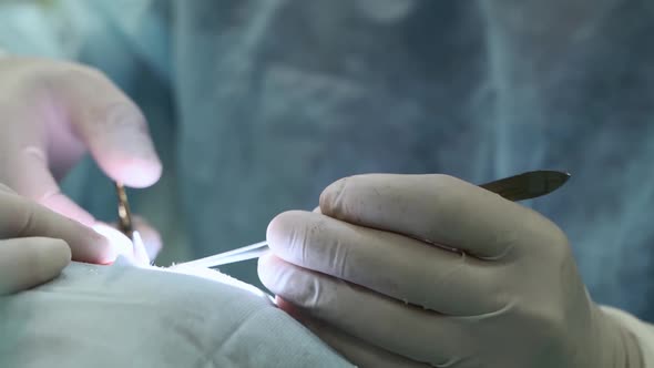 Closeup of Doctors Hands Performing Complex Operation
