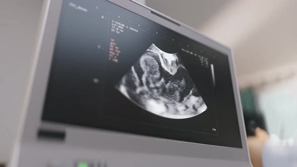 Monitoring scanner is analyzing the condition of a child in womb at the clinic alt