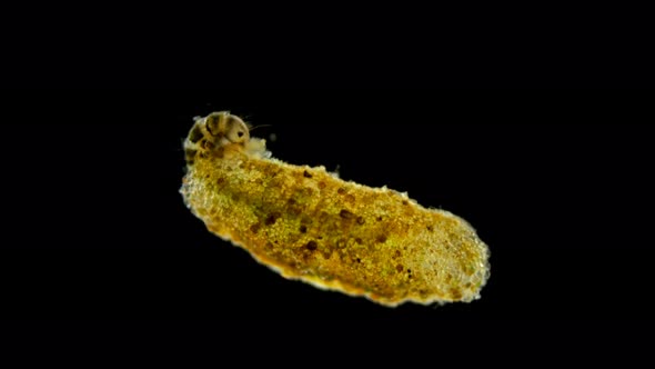 Trichoptera Larvae Under the Microscope alt