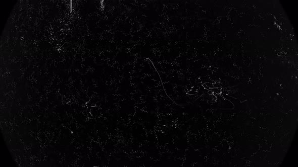 Colony of Bacteria Spirochetes  alt