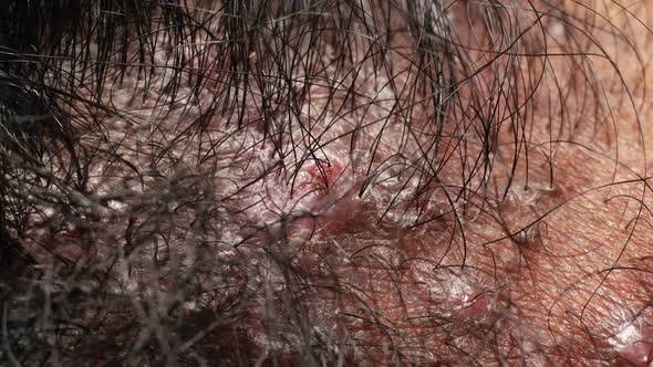 Infected Human Skin Texture alt