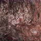 Infected Human Skin Texture - VideoHive Item for Sale