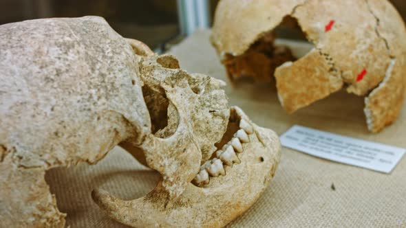 Human Skull in a Showcase alt