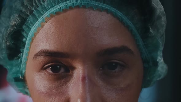 Woman doctor on her face marks are visible from protective mask, red spots alt
