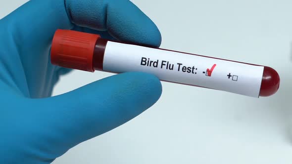 Bird Flu Test, Doctor Holding Blood Sample in Tube Close-Up, Health Check-Up alt