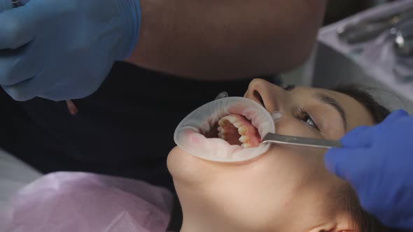 Suturing of the Damaged Area in the Patient's Mouth After Tooth Extraction
