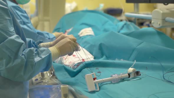 Two Women Carried Out an Operation on the Veins