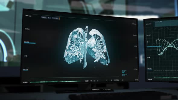 Lung Cancer Illness Diagnosis Health Care Examination System Interface alt