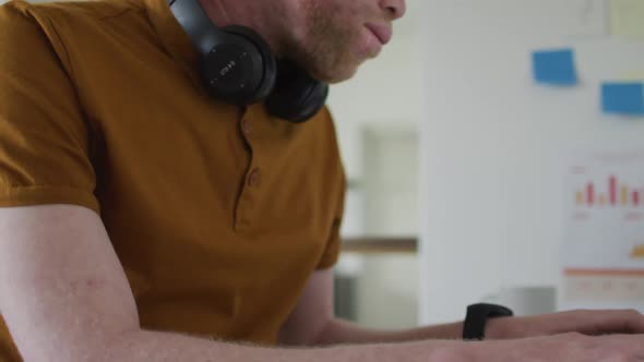 Albino african american man with dreadlocks working on the laptop alt